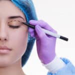 ragazza che si sottoporrà ad intervente do blefaroplastica e cirurgo che traccia le linee intorno agli occhi